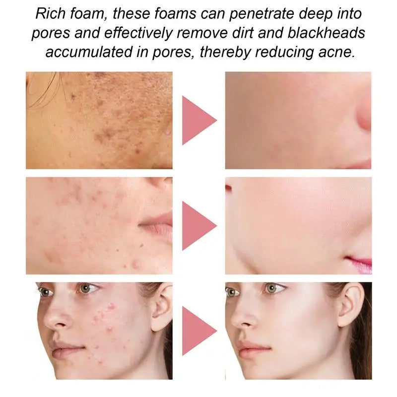 Facial Foaming Cleanser Deep Cleansing Face Wash