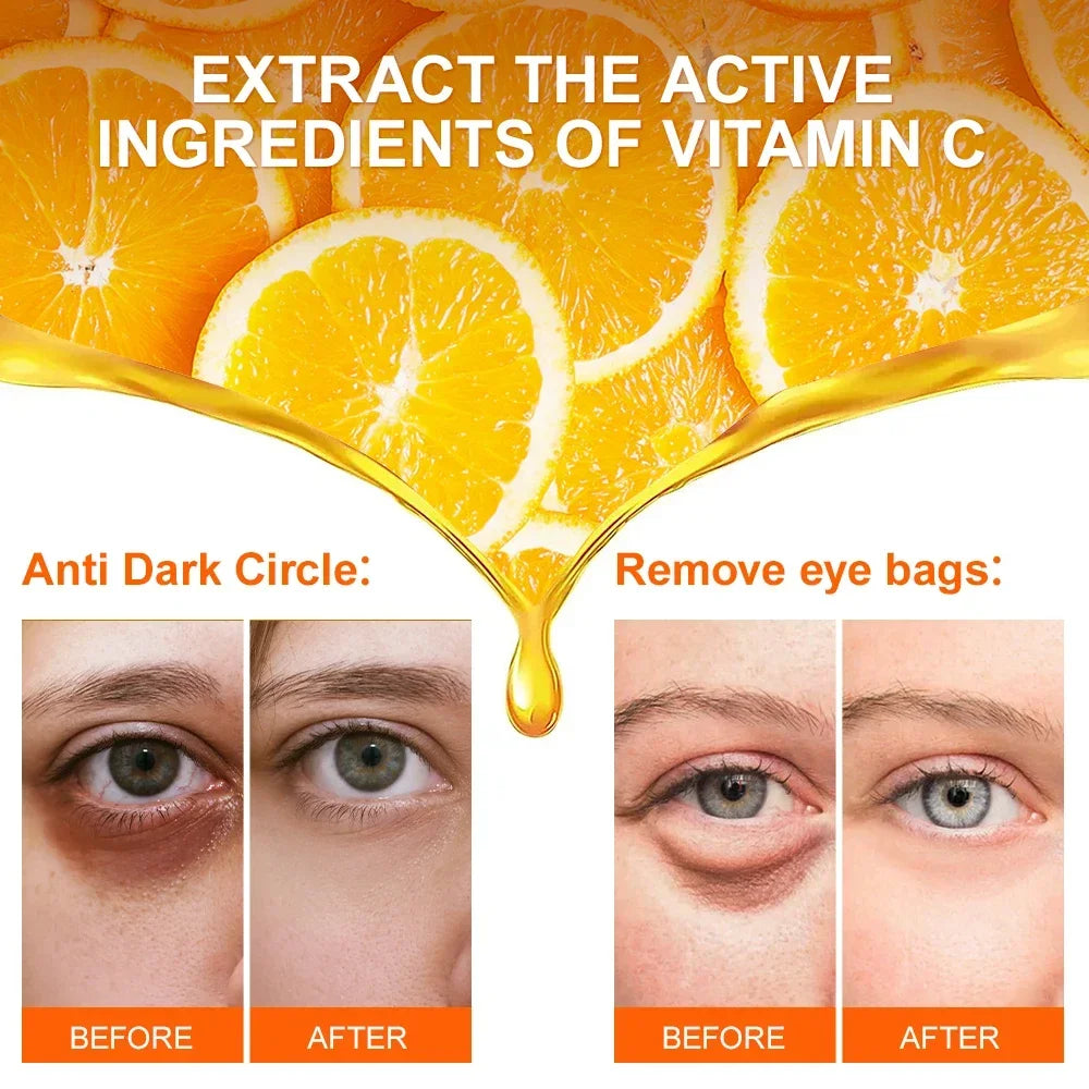 Eye Cream Dark Circles