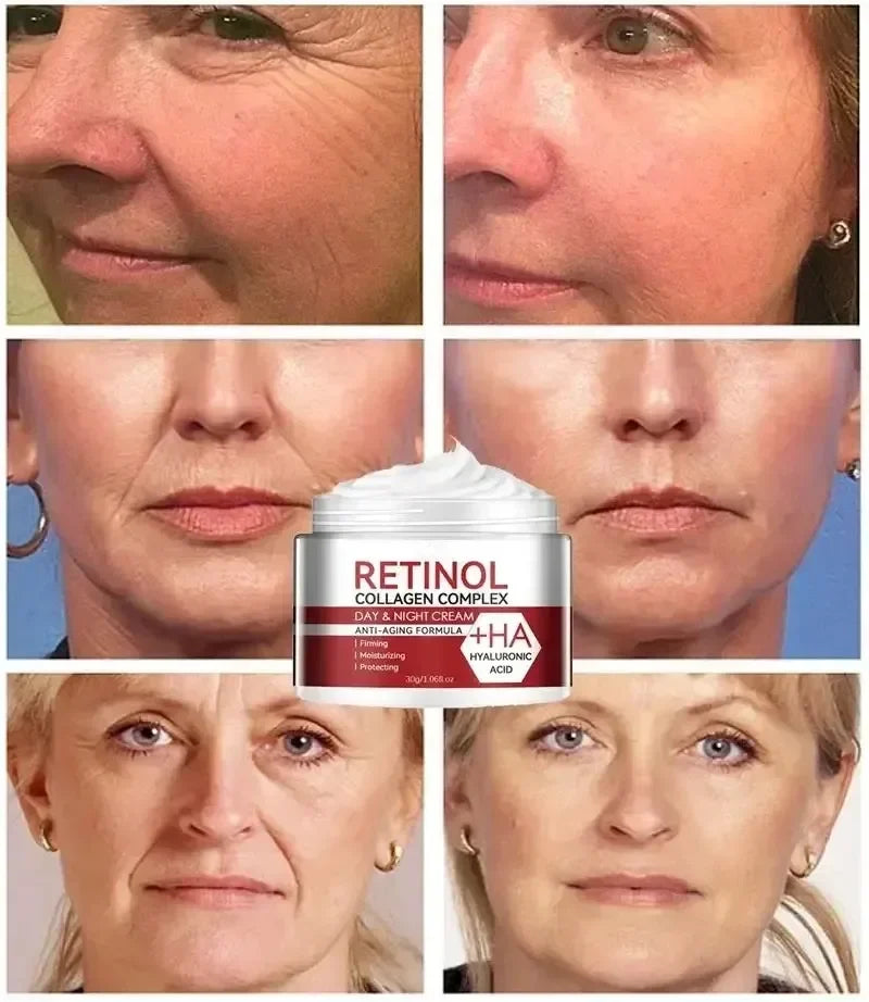Retinol Cream