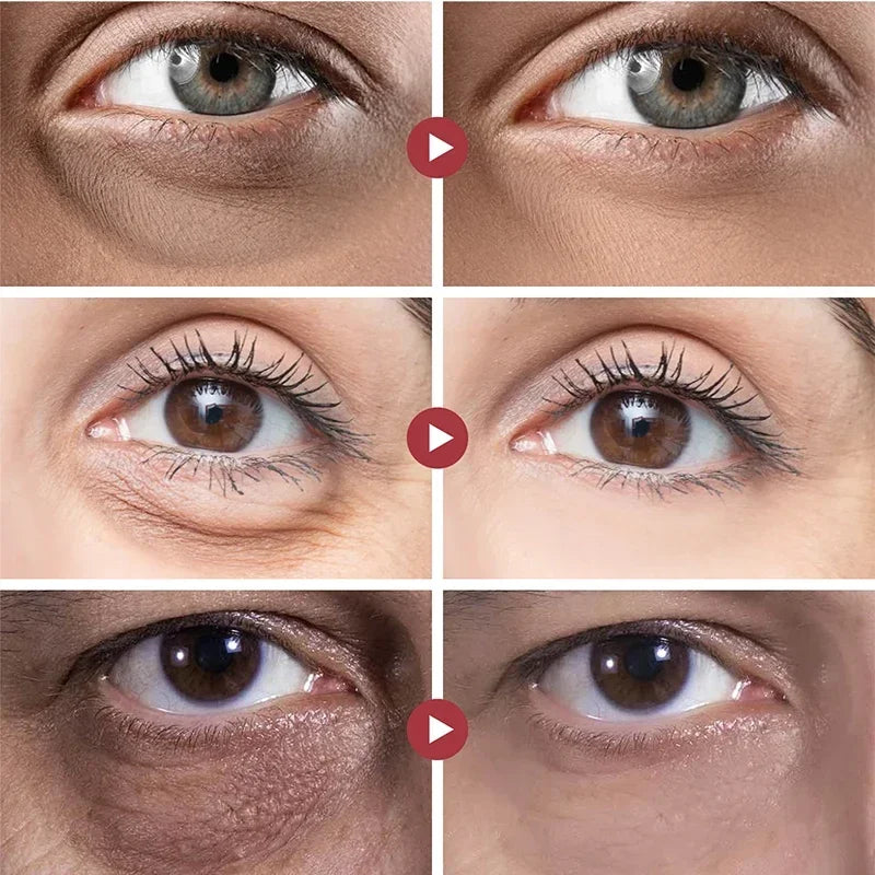 Eye Cream Dark Circles