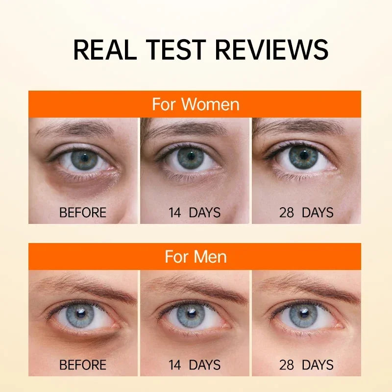 Eye Cream Dark Circles