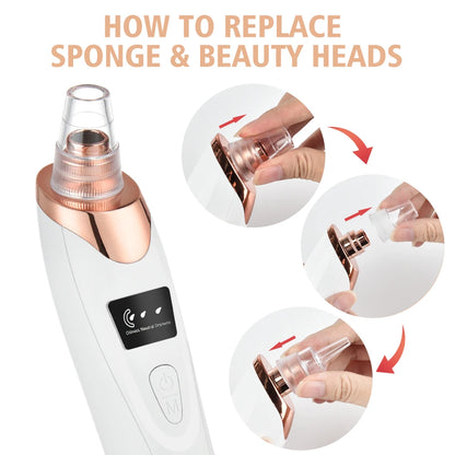 Electric Blackhead Remover Vacuum Cleaner